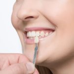 how to care for your veneers tips for a long-lasting smile