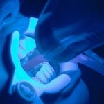 fluoride treatment help with tooth sensitivity