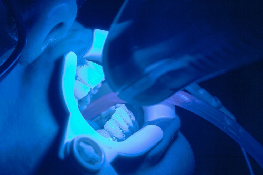 fluoride treatment help with tooth sensitivity